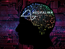 Neuralink Postpones Second Brain Implant Surgery Due to Health Issues